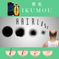 Thumbnail for IKUMOU Hair Loss Treatment Shampoo (Net Wt. 250ml / 8.45oz)