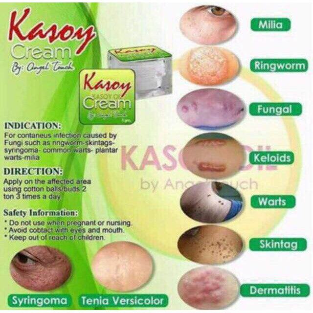 Kasoy Cream Warts Remover 10grm