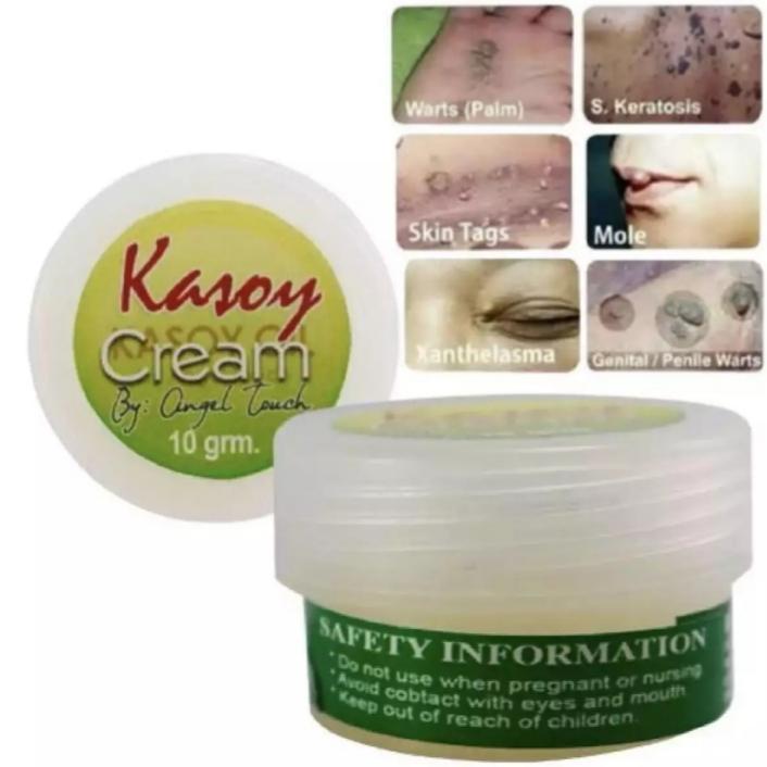 Kasoy Cream Warts Remover 10grm