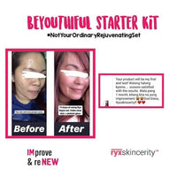 Thumbnail for Ryx Beyouthiful Starter Kit