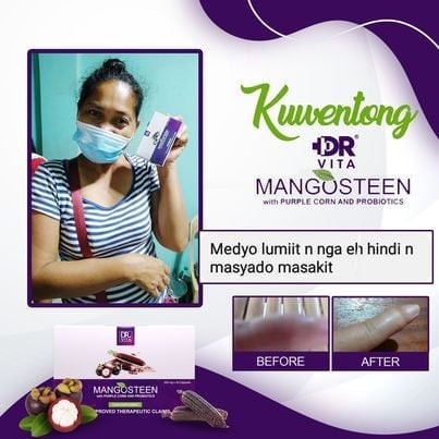[Buy 1 Take 1] Dr. Vita Mangosteen with Purple Corn