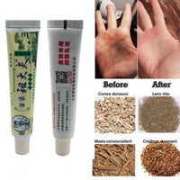 Thumbnail for Zudaifu Chinese Herbal Skin Psoriasis Cream (Dermatitis, Eczematoid & Eczema)