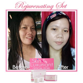 Skin Luxuriant Rejuvenating Derma Facial Set