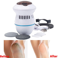 Thumbnail for Pedi Vac by PedEgg Rechargeable Foot File and Callus Remover