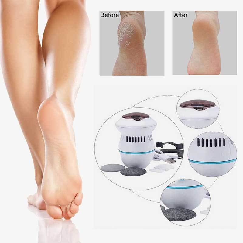 Pedi Vac by PedEgg Rechargeable Foot File and Callus Remover
